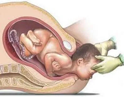 Como funciona o parto normal